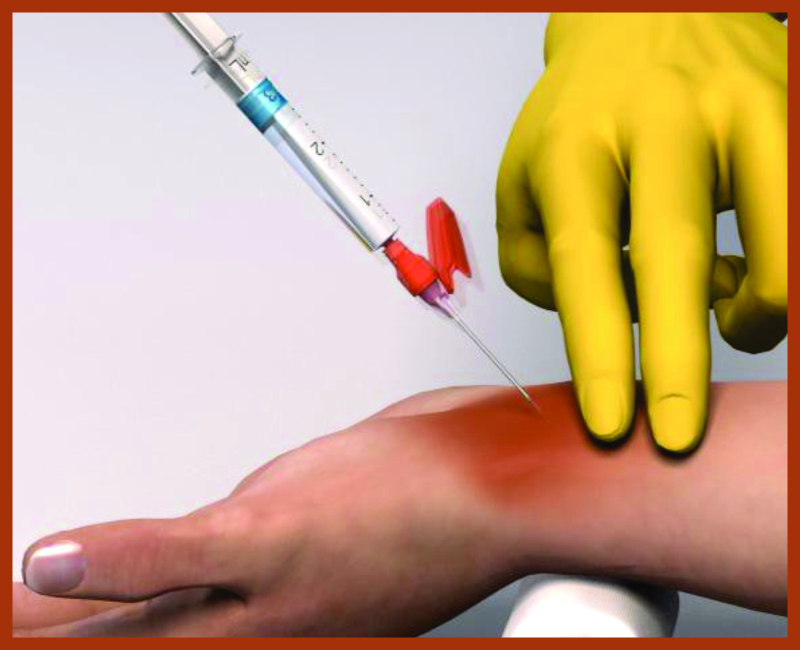 ARTERIAL BLOOD GASES TEST